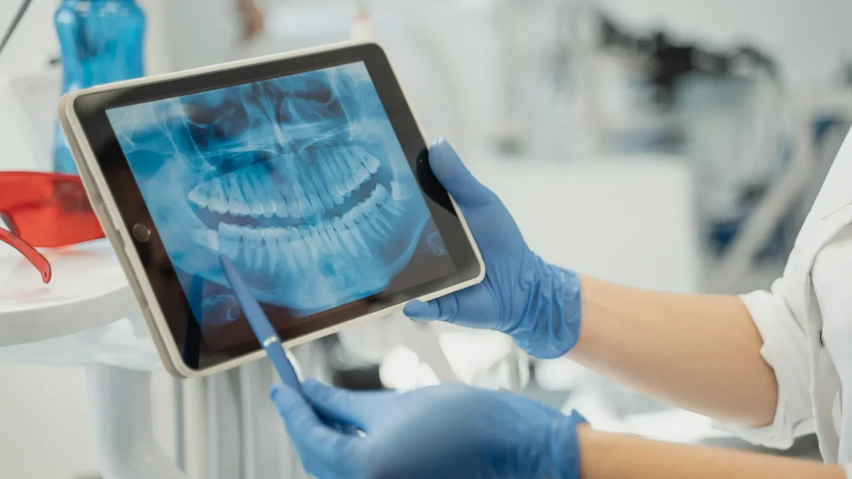 Dientes con infección